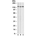 Western blot testing of Daudi (A), Jurkat (B) and HeLa (C) lysates with ADAM17 antibody at 0.3ug/ml. Expected molecular weight: 80-130 kDa depending on level of glycosylation