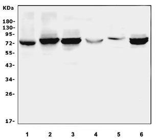 Western blot testing of 1) rat lung, 2) rat thymus, 3) rat spleen, 4) mouse lung, 5) mouse testis and 6) mouse thymus tissue lysate with ALOX15 antibody. Predicted molecular weight ~75 kDa.