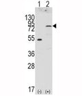 Western blot analysis of FGFR4 antibody and 293 cell lysate (2 ug/lane) either nontransfected (Lane 1) or transiently transfected with the FGFR4 gene (2).