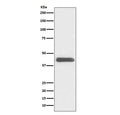 Western blot testing of human K562 cell lysate with GATA1 antibody. Predicted molecular weight ~43 kDa.