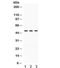 Western blot testing of 1) rat brain, 2) mouse brain and 3) human U87 lysate with OMG antibody. Predicted molecular weight: ~50/150 kDa (unmodified/glycosylated).