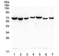 Western blot testing of human 1) HeLa, 2) COLO-320, 3) SW620, 4) A431, 5) A549, 6) HepG2 and 7) PANC-1 lysate with HSP70 antibody at 0.5ug/ml. Expected molecular weight ~70 kDa.