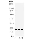 Western blot testing of human 1) placenta, 2) A431 and 3) HeLa lysate with MIG antibody. Expected/observed molecular weight ~19 kDa.