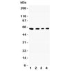 Western blot testing of CADM1 antibody and Lane 1: A549; 2: Jurkat; 3: Raji; 4: HeLa lysate. Predicted molecular weight: ~48/37kDa (isoforms 1/2) with N-linked and O-linked glycosylation each possibly adding ~25kDa to the observed size.