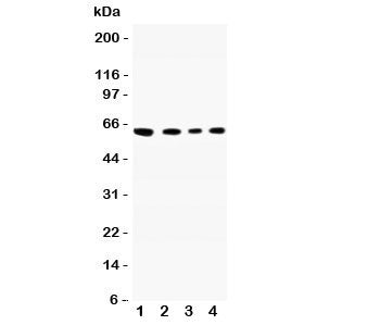 Western blot testing of CADM1 antibody and Lane 1: A549; 2: Jurkat; 3: Raji; 4: HeLa lysate. Predicted molecular weight: ~48/37kDa (isoforms 1/2) with N-linked and O-linked glycosylation each possibly adding ~25kDa to the observed size.