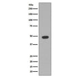 Western blot testing of rat brain lysate with GFAP antibody. Predicted molecular weight ~50 kDa.