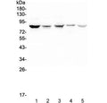 Western blot testing of human 1) HeLa, 2) placenta, 3) SCG-7901, 4) Jurkat and 5) THP-1 lysate with NOX5 antibody at 0.5ug/ml. Predicted molecular weight: ~86 kDa.
