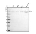 Western blot analysis of PDE4B using anti-PDE4B antibody. Electrophoresis was performed on a 10% SDS-PAGE gel at 80V (Stacking gel) / 120V (Resolving gel) for 2 hours. Lane 1: human whole cell lysates, Lane 2: human HepG2 whole cell lysates, Lane 3: human U251 whole cell lysates, Lane 4: mouse brain tissue lysates. After electrophoresis, proteins were transferred to a nitrocellulose membrane at 150 mA for 50-90 min. Blocked the membrane with 5% non-fat milk/TBS for 1.5 hour at RT.