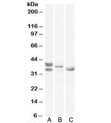 Western blot testing of A) human, B) mouse and C) rat heart lysates with Renalase antibody at 0.5ug/ml. Molecular weight: observed in human/mouse/rat samples between 33~38 kDa.