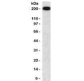 Western blot testing of human brain lysate with recombinant NF-H antibody (clone NFHP-1R). Expected molecular weight ~200 kDa.