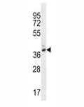 PGA4 antibody western blot analysis in WiDr lysate.