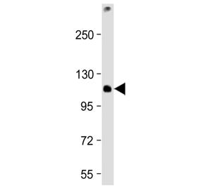 Western blot testing of mouse EL4 cell lysate with TCIRG1 antibody at 1:2000. Predicted molecular weight ~93 kDa, routinely observed at ~116 kDa.