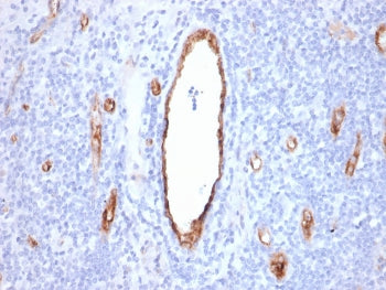 IHC staining of FFPE human tonsil with vWF antibody (clone VWF/2480). HIER: boil tissue sections in pH 9 10mM Tris with 1mM EDTA for 20 min and allow to cool before testing.