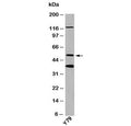 Western blot testing of human samples with TXNIP antibody at 1ug/ml.