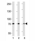 Western blot analysis of lysate from (1) U266, (2) HepG2 cell line, (3) mouse brain tissue lysate using CD73 antibody at 1:2000. Predicted molecular weight: 65-70 kDa.
