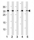 Western blot analysis of lysate from (1) A549, (2) HeLa, (3) HepG2, (4) Jurkat, (5) mouse NIH3T3 cell line using DKK1 antibody. Predicted molecular weight: 26-40 kDa depending on glycosylation level.