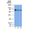 Western blot testing of human 1) A431, 2) A549 and 3) MCF7 cell lysate with Beta Catenin antibody (clone 9F2). Predicted molecular weight ~85 kDa, but routinely observed at 90-95 kDa.