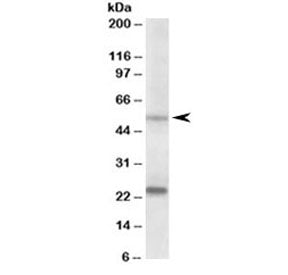Western blot testing of human prostate lysate with MMP3 antibody at 0.2ug/ml. Molecular weight: the expected ~54 kDa band and the additional ~24kDa band are both blocked by the immunizing peptide.