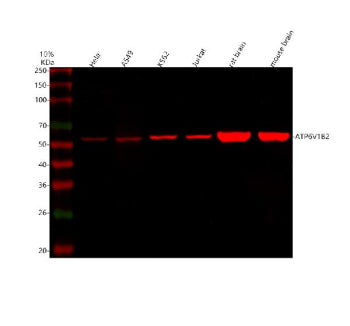 Western blot analysis of ATP6V1B2 using anti-ATP6V1B2 antibody. Lane 1: human Hela whole cell lysates, Lane 2: human whole cell lysates, Lane 3: human K562 whole cell lysates, Lane 4: human Jurkat whole cell lysates, Lane 5: rat brain tissue lysates, Lane 6: rat H9C2(2-1) whole cell lysates, Lane 7: mouse brain tissue lysates, Lane 8: mouse C2C12 whole cell lysates. After electrophoresis, proteins were transferred to a nitrocellulose membrane at 150 mA for 50-90 min.