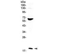 Western blot testing of human HepG2 cell lysate with CD40L antibody at 0.5ug/ml. Expected molecular weight: 29-39 kDa (depending on glycosylation level) or ~18 kDa (soluble form).