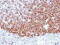 IHC staining of FFPE human tonsil tissue with Ki67 antibody (clone MKI67/6571). HIER: boil tissue sections in pH 9 10mM Tris with 1mM EDTA for 20 min and allow to cool before testing.