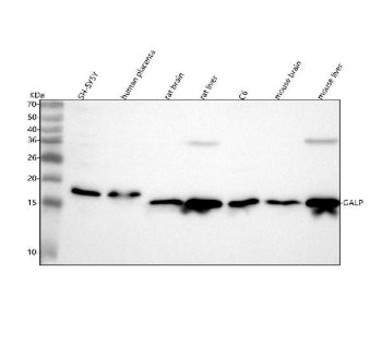 Western blot analysis of GALP using anti-GALP antibody. Lane 1: human SH-SY5Y whole cell lysates, Lane 2: human placenta tissue lysates, Lane 3: rat brain tissue lysates, Lane 4: rat liver tissue lysates, Lane 5: rat C6 whole cell lysates, Lane 6: mouse brain tissue lysates, Lane 7: mouse liver tissue lysates. After electrophoresis, proteins were transferred to a nitrocellulose membrane at 150 mA for 50-90 min. Blocked the membrane with 5% non-fat milk/TBS for 1.5 hour at RT.