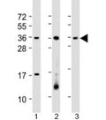 Western blot testing of human 1) HL-60, 2) Jurkat and 3) K562 cell lysate with RSPO1 antibody at 1:2000. Predicted molecular weight: 29 kDa.