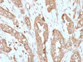 IHC testing of FFPE human small intestine with recombinant Villin antibody (clone VIL1/2310R). Required HIER: boil tissue sections in 10mM citrate buffer, pH 6, for 10-20 min followed by cooling at RT for 20 min.