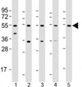 Western blot testing of human 1) liver, 2) HeLa, 3) PC-3, 4) SK-BR-3 and 5) TT cell lysate with THRB antibody at 1:2000. Predicted molecular weight: 52 kDa.