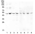 Western blot testing of human 1) Caco-2, 2) PC-3, 3) A549, 4) HeLa, 5) rat stomach, 6) rat testis, 7) mouse testis and 8) mouse liver lysate with KCNN4 antibody at 0.5ug/ml. Predicted molecular weight ~48 kDa.