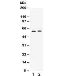 Western blot testing of human 1) K562 and 2) Jurkat cell lysate with MMP-8 antibody. Expected molecular weight: 55 kDa (latent), 46, 42 kDa (active).