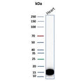 Western blot testing of different lots of human heart lysate with H-FABP antibody. Predicted molecular weight ~14 kDa.