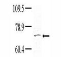 Western blot analysis of TNK1 antibody (1:100) in HeLa lysate; Courtesy of Dr. Richard Lu, Partners HealthCare System at Harvard University.