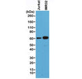 Western blot of human Jurkat and IMR32 cell lysate using recombinant SMAD4 antibody at 1:500. Predicted molecular weight ~60 kDa.