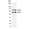 Western blot testing of RGS9 antibody and Lane 1: rat brain; 2: mouse brain tissue lysate. Predicted molecular weight: 50-77 kDa (multiple isoforms).
