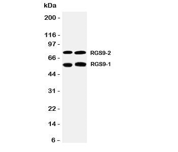 Western blot testing of RGS9 antibody and Lane 1: rat brain; 2: mouse brain tissue lysate. Predicted molecular weight: 50-77 kDa (multiple isoforms).