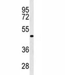 Western blot analysis of GATA6 antibody in WiDr lysate. Predicted molecular weight: 60, 45 kDa (isoforms 1, 2).