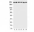 Western blot testing of Mucin-5AC antibody and Lane 1: SGC; 2: HeLa; 3: COLO320; 4: SW620; 5: MCF-7; 6: PANC lysate; Predicted size: ~500KD, Observed size: 300KD+