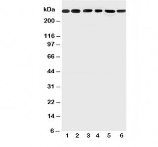 Western blot testing of Mucin-5AC antibody and Lane 1: SGC; 2: HeLa; 3: COLO320; 4: SW620; 5: MCF-7; 6: PANC lysate; Predicted size: ~500KD, Observed size: 300KD+