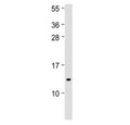 Western blot testing of IFI27 antibody at 1:500 + human spleen lysate. Predicted molecular weight ~11 kDa.
