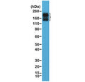 Western blot testing of human brain lysate with recombinant CD56 antibody at 1:2000 dilution. Predicted molecular weight: ~110 kDa (soluble fragment), ~120/125 kDa (GPI-anchored), 140/180 kDa (transmembrane isoforms).