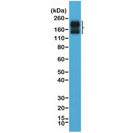 Western blot testing of human brain lysate with recombinant CD56 antibody at 1:2000 dilution. Predicted molecular weight: ~110 kDa (soluble fragment), ~120/125 kDa (GPI-anchored), 140/180 kDa (transmembrane isoforms).