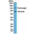 Western blot testing of human 22RV1 cell lysate with recombinant Androgen Receptor antibody. Full length Androgen Receptor and splice variants may be observed.