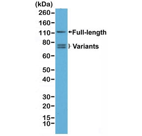 Western blot testing of human 22RV1 cell lysate with recombinant Androgen Receptor antibody. Full length Androgen Receptor and splice variants may be observed.