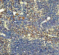 Immunohistochemical staining of Gp9 using anti-Gp9 antibody. Gp9 was detected in a paraffin-embedded section of mouse spleen tissue. Heat mediated antigen retrieval was performed in EDTA buffer (pH 8.0, epitope retrieval solution). The tissue section was blocked with 10% goat serum. The tissue section was then incubated with 2 ug/ml rabbit anti-Gp9 antibody overnight at 4oC. Peroxidase Conjugated Goat Anti-rabbit IgG was used as secondary antibody and incubated for 30 min at 37oC.