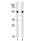 Western blot analysis of lysate from 1) mouse NIH3T3 and 2) rat C6 cell line using Srf antibody at 1:1000. Predicted molecular weight: ~52/60-70kDa (unmodified/phosphorylated).