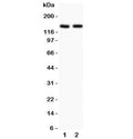 Western blot testing of Hamartin antibody and Lane 1: rat brain; 2: human HeLa lysate. Expected/observed molecular weight: 130~150 kDa.