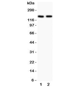 Western blot testing of Hamartin antibody and Lane 1: rat brain; 2: human HeLa lysate. Expected/observed molecular weight: 130~150 kDa.