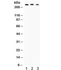 Western blot testing of 1) rat brain, 2) mouse brain and 3) U87 cell lysate with SCN1A antibody. Predicted molecular weight ~229 kDa but routinely observed at ~250 kDa.
