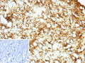 IHC staining of FFPE human brain tissue with MBP antibody (clone rMBP/9431). Inset: PBS used in place of primary Ab (secondary Ab negative control). HIER: boil tissue sections in pH 9 10mM Tris with 1mM EDTA for 20 min and allow to cool before testing.